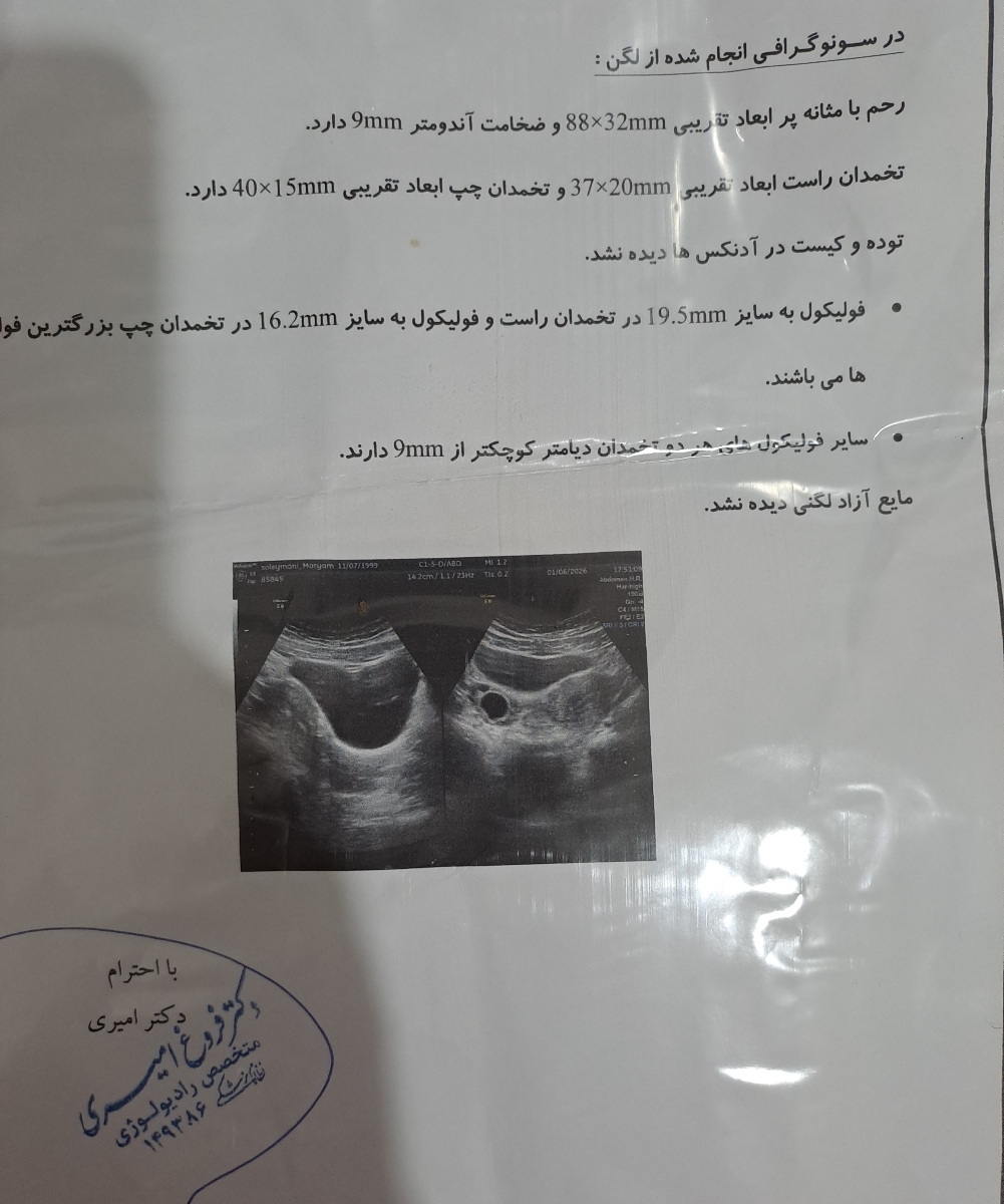 اقدام به بارداری ناموفق