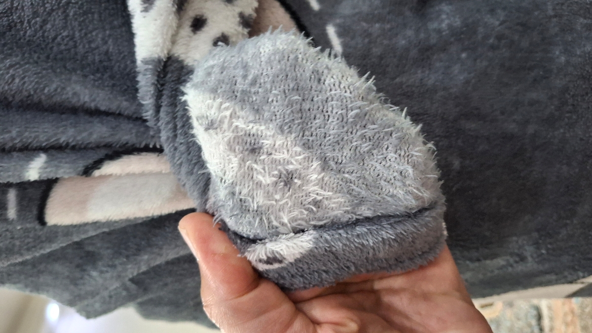 عمل واریکوسل و رعایت های بعد ان