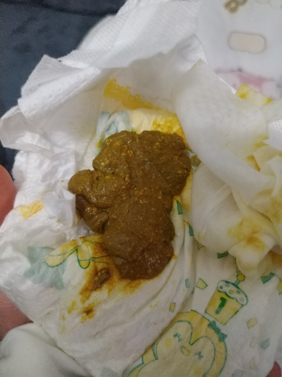 با عرض معذرت
هر سری مدفوع میکنه دو سه برابر این مقدار. داخل پوشکم هست با عرض معذرت
هر سری مدفوع میکنه دو سه برابر این مقدار. داخل پوشکم هست