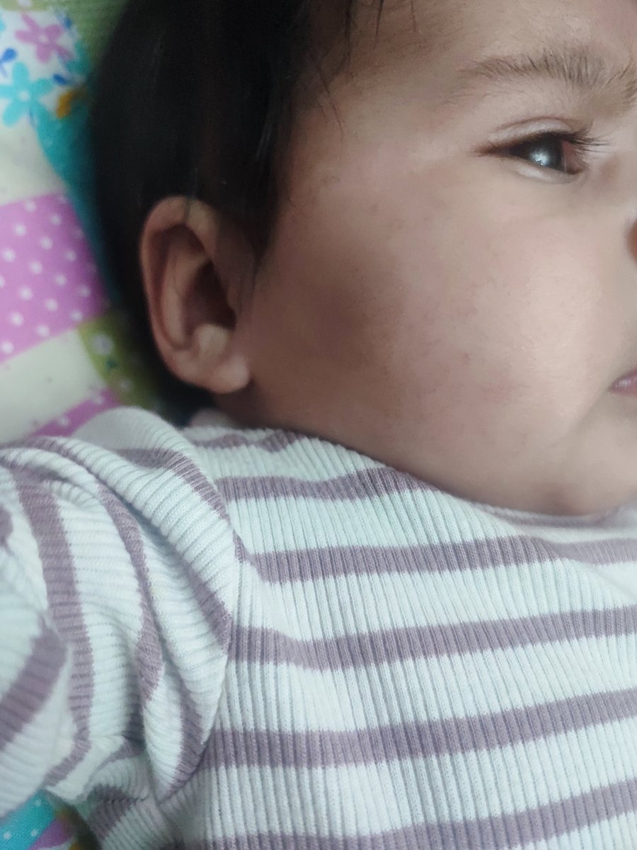 صورتش روشنتر شده صورتش روشنتر شده