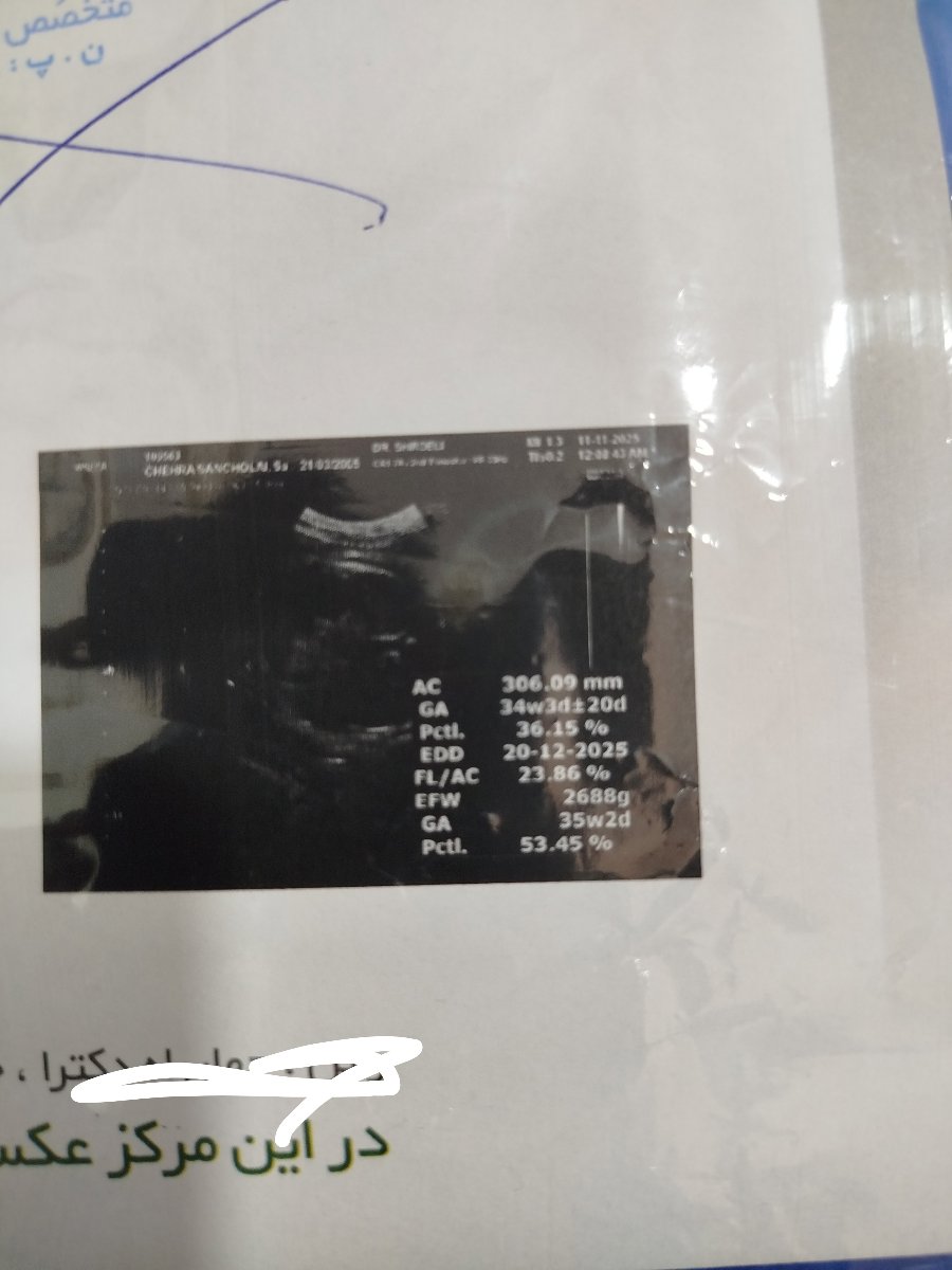 دلیل سفت کردن بچه
