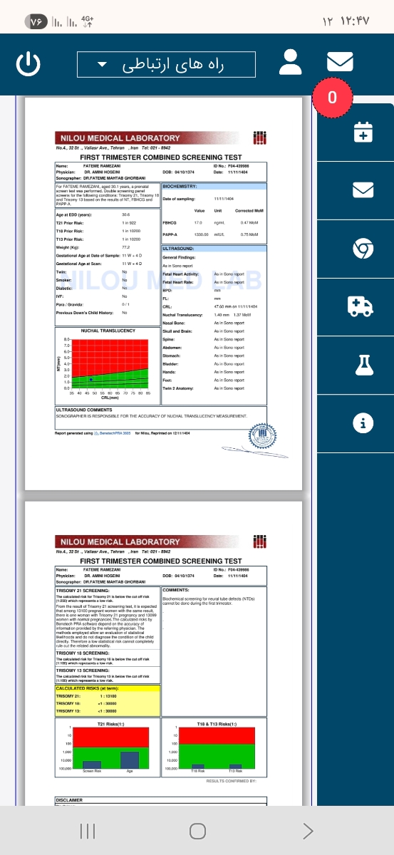 بررسی جواب سونوگرافی nt بررسی جواب سونوگرافی nt