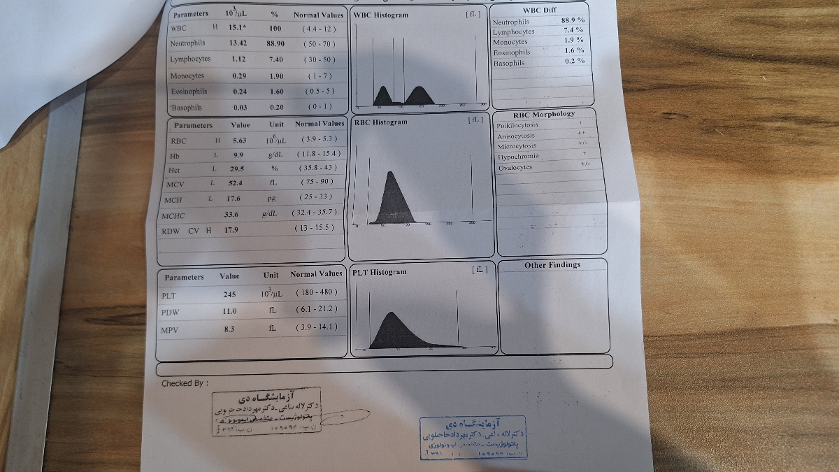 تف سیر ازما یش