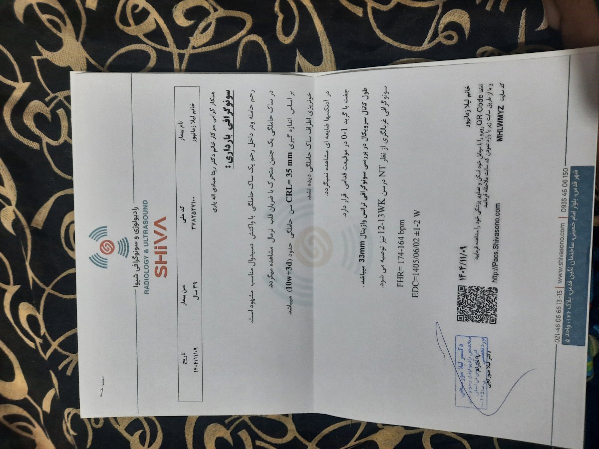 با توجه به سابقه سقط بارداری دوم باید انوکساپارین و پردنیزولون مصرف کنم