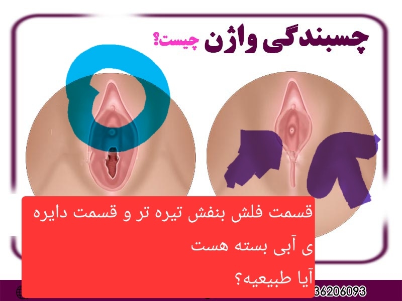 رنگ تیره تر آلت تناسلی دختر رنگ تیره تر آلت تناسلی دختر