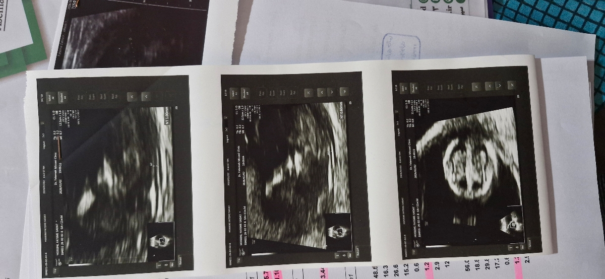 سونو ان تی نگفتن جنسیت🥲