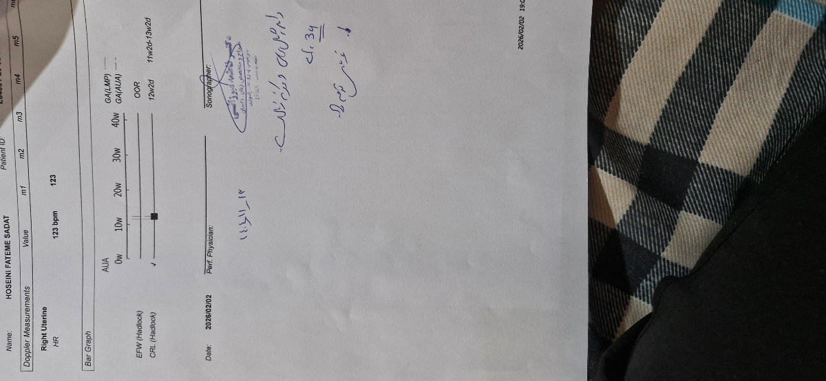 سونو ان تی نگفتن جنسیت🥲