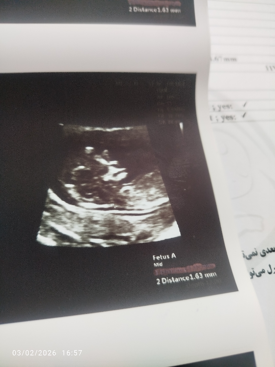 خانما بیاید حدس بزنید