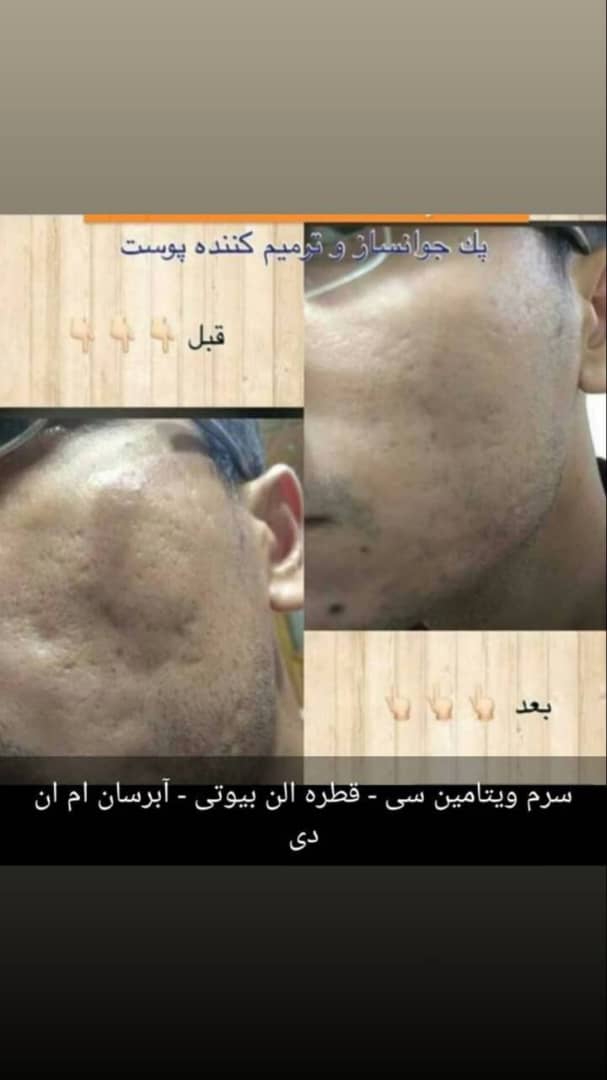 کیااینجا پوستشون رو سابسیژن انجام دادند وکیا مزوژل میشه بگید چطوره