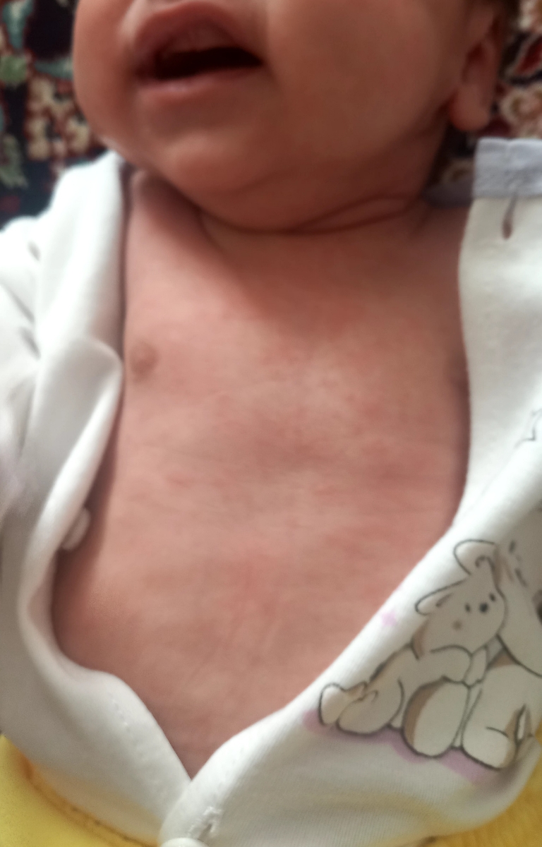 دون دون شدن بدن دخترم و مدفوع خلطی دون دون شدن بدن دخترم و مدفوع خلطی