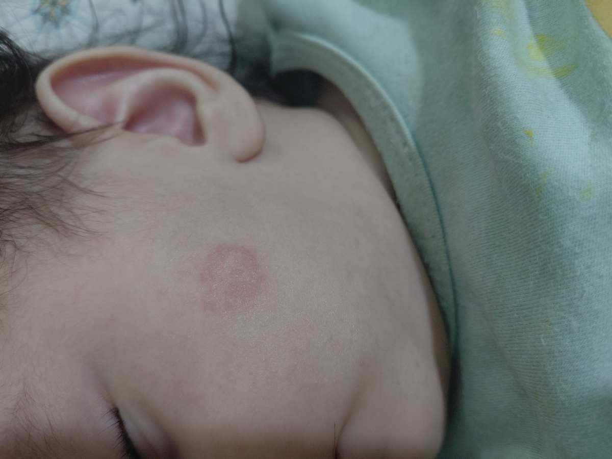 یبوست و قرمز شدن صورت نوزاد