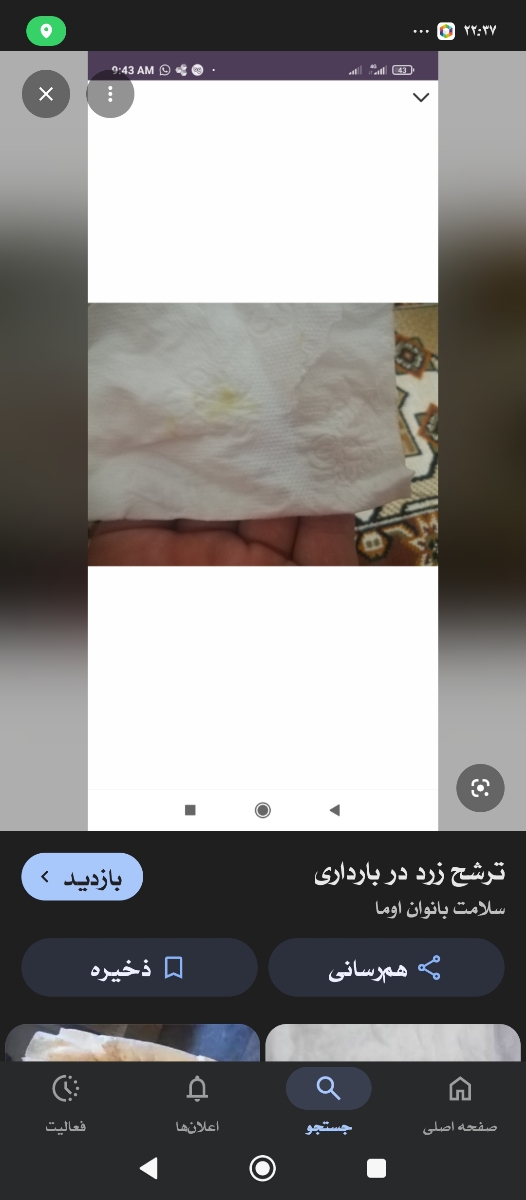 ترشح در هفته ۱۳ بارداری ترشح در هفته ۱۳ بارداری