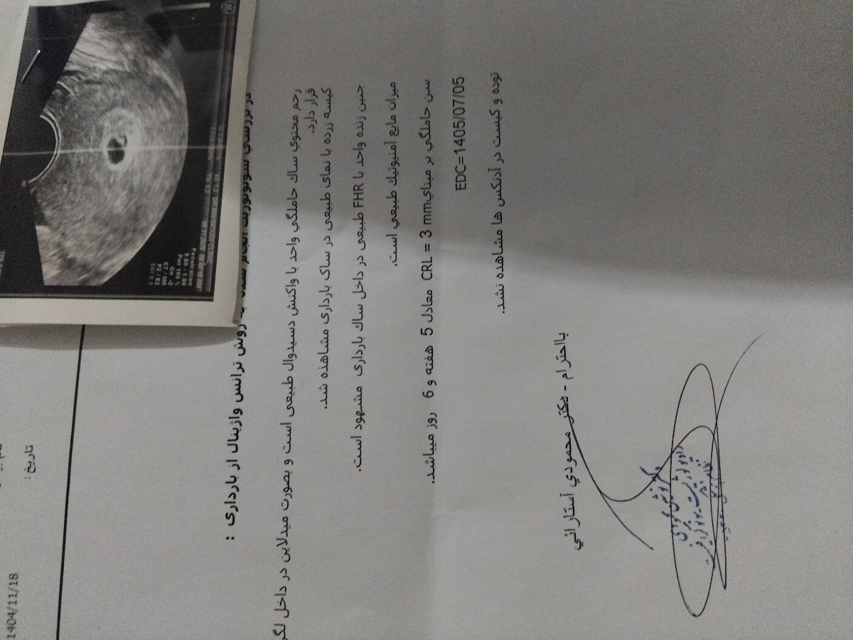خونریزی هفته ۵ یارداری