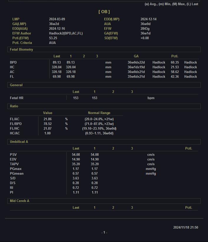 ✅️✅️✅️تفسیر سونو داپلر۳۶ هفته🙏🏻