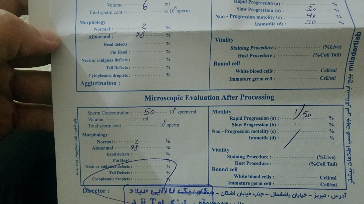 آزمایش ایمنی انعقادی مربوط به سقط