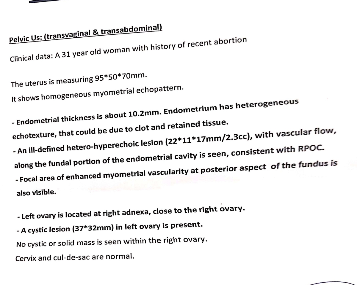 خانم دکتر سونو بقایای بارداری رو ببینید