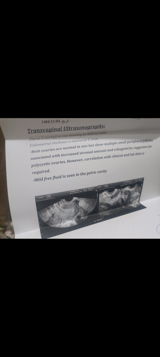 تفسیر جواب آزمایش و کم بودن ذخیره تخمدان