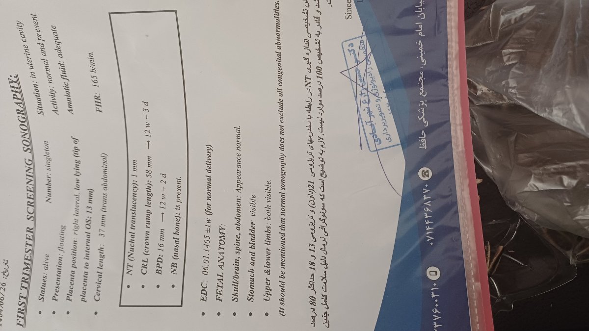 سزارین درچند هفته بهتره؟