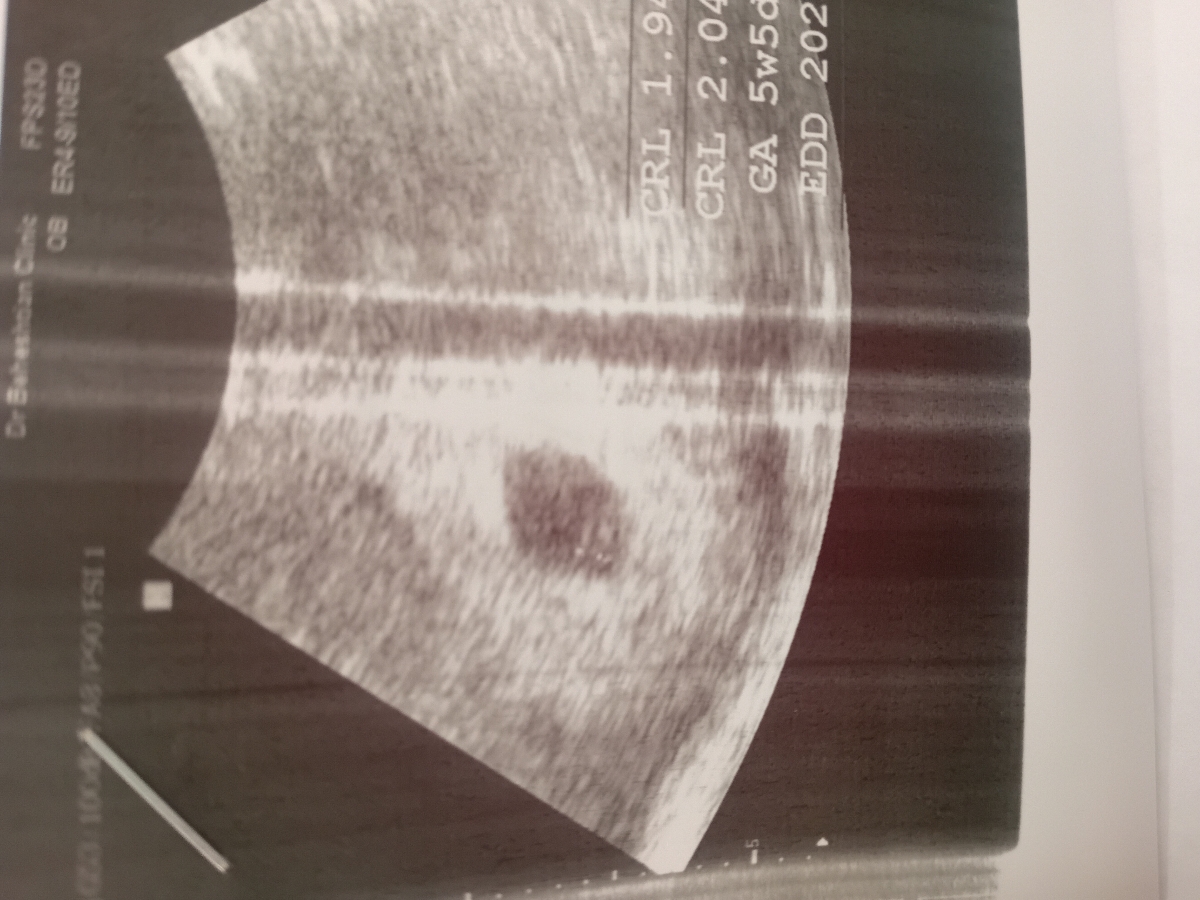 این چیه داخل عکس