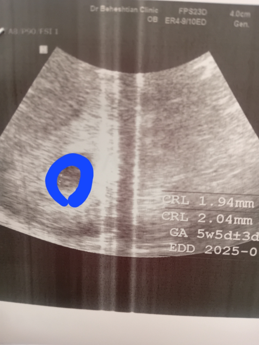 این چیه داخل عکس