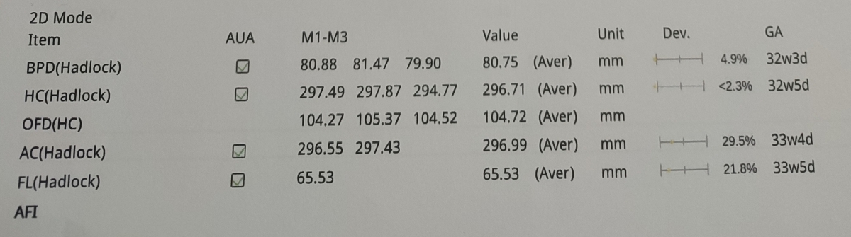 کم بودن دور سر جنین و احتمال میکروسفالی