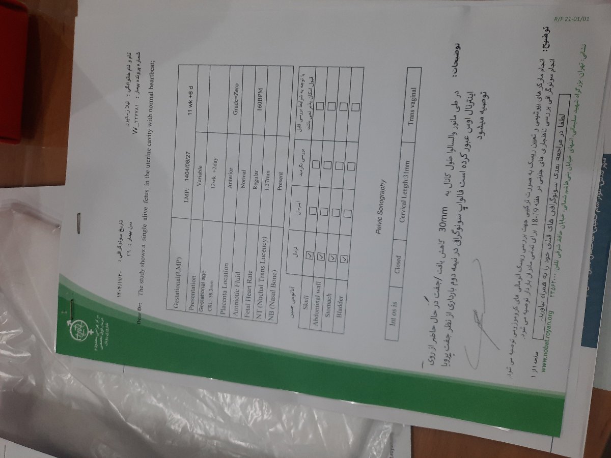 لکه بینی هفته ۱۲
