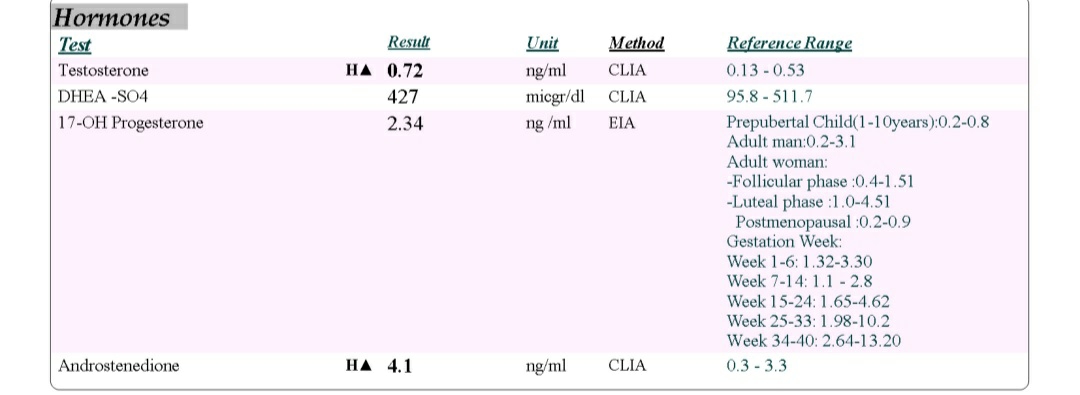 تفسیر سونو و ازمایش تفسیر سونو و ازمایش