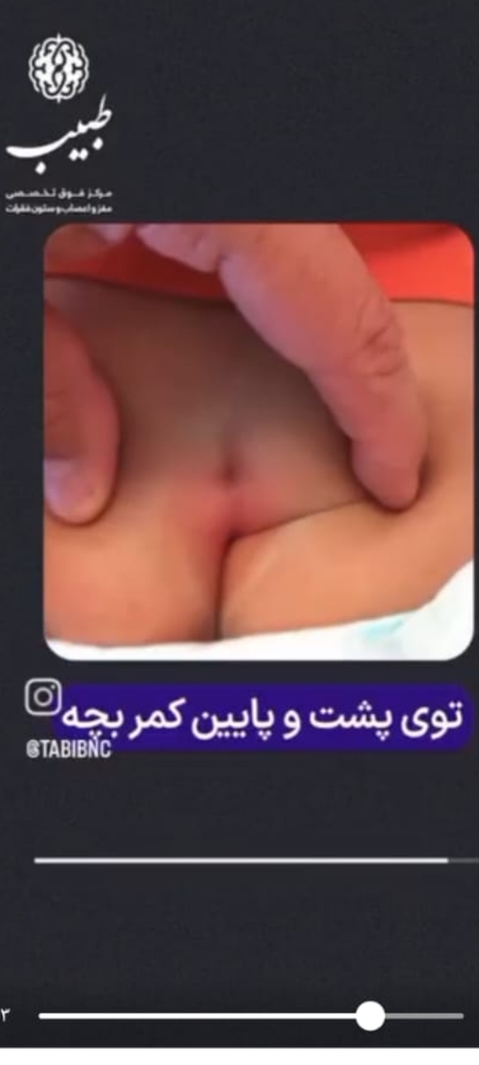 عکسی که خود دکتر گذاشته بود اینطوره