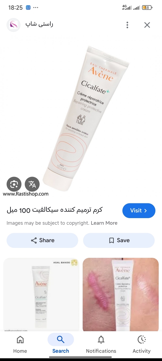 سوختگی دست عکس‌گذاشتم لطفا اگه دوست ندارین باز نکنید