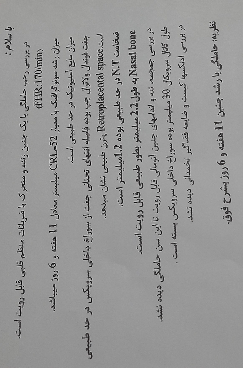 اینم جواب سونو