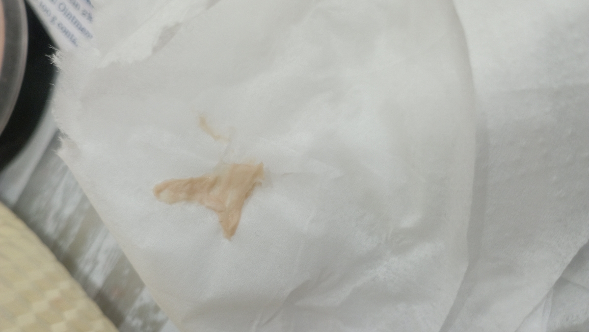 ترشحات بعد از قطع قرص