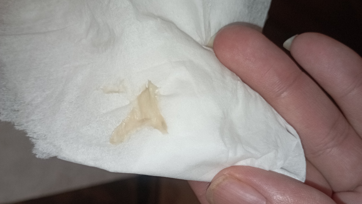 ترشحات بعد از قطع قرص