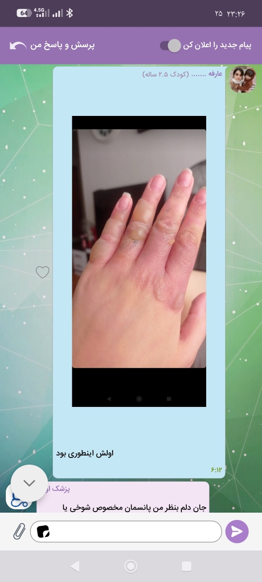 عزیزم این دست منه