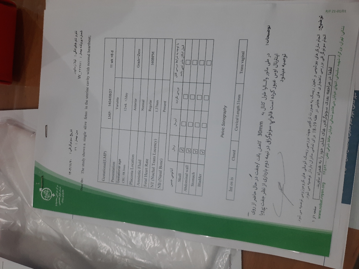 این سونو ان تی من نگاه کنید 