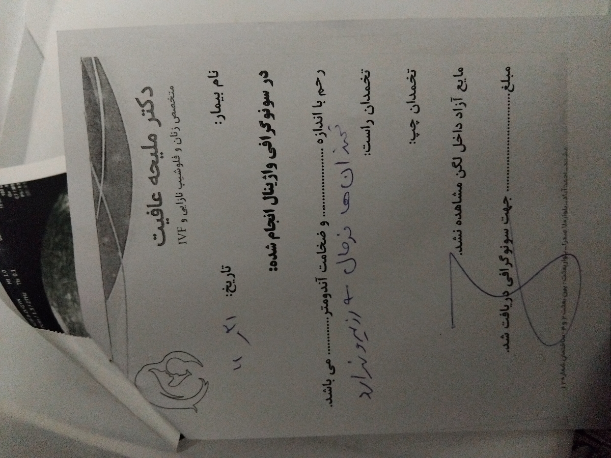 دوران بعد سقط جنین