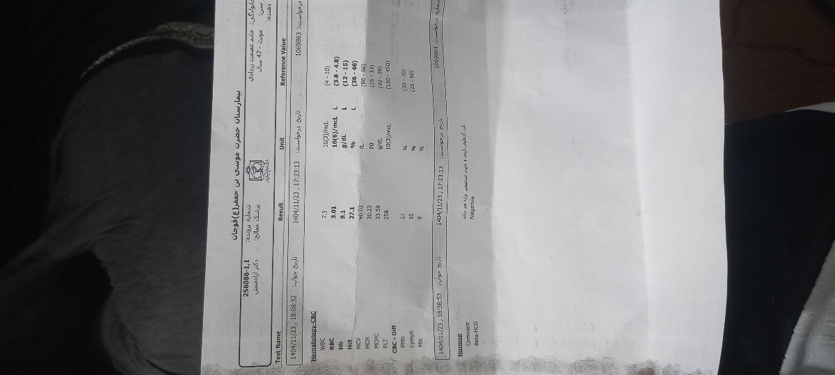 کشیدن دندان اسیاب بزرگ