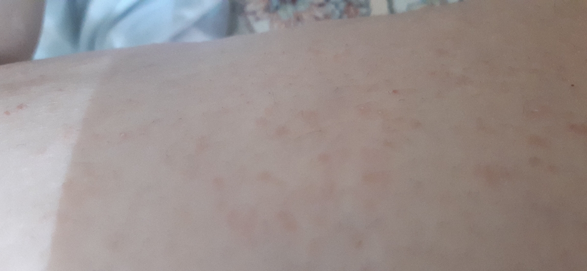 بیرون ریختن بدن زمان شیردهی