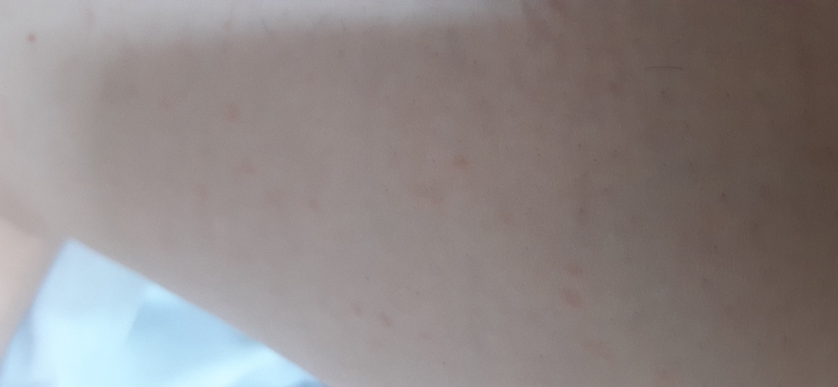 بیرون ریختن بدن زمان شیردهی