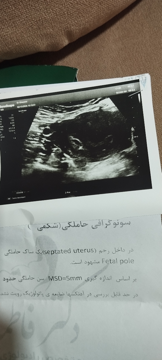 تفسیر سونوگرافی بارداری