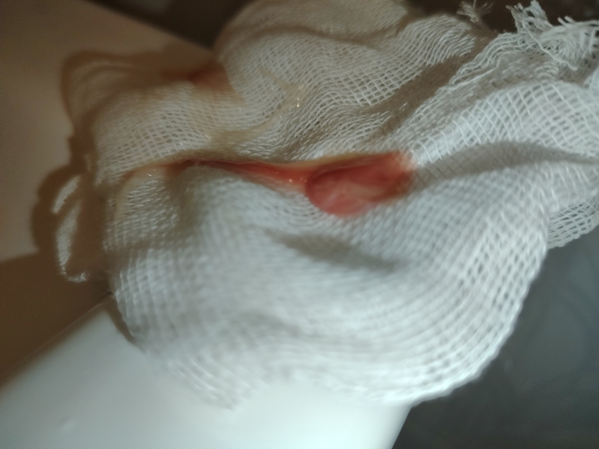 لکه بینی همراه عکسسسس🩸🩸