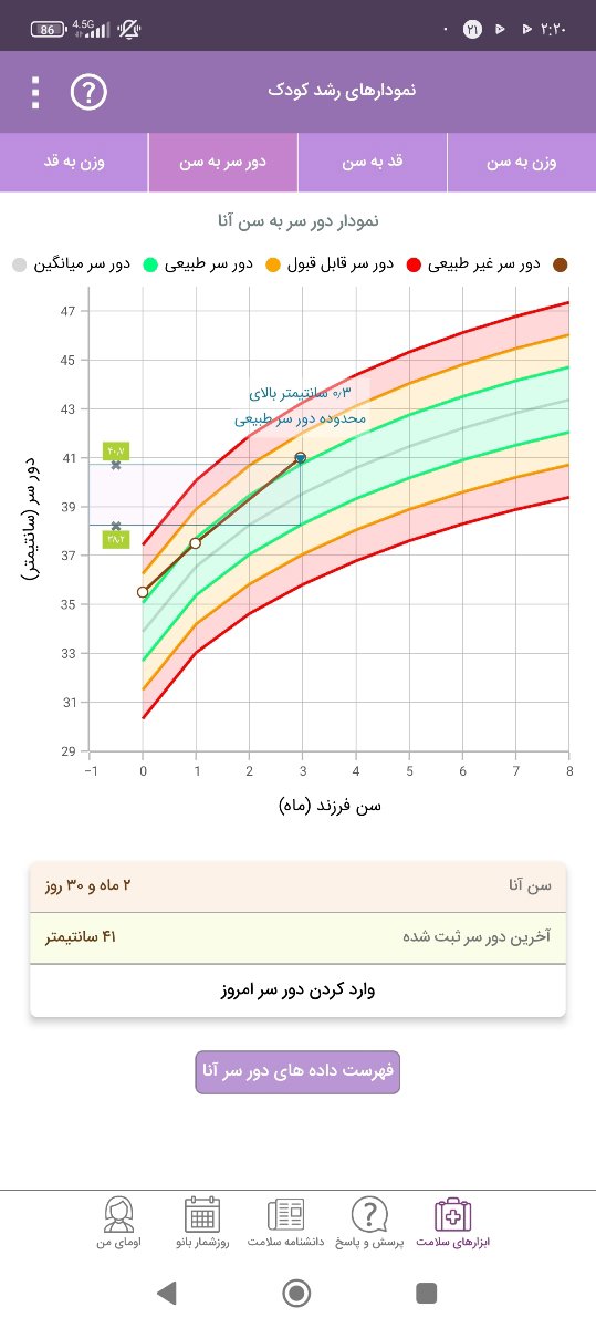 دور سر
