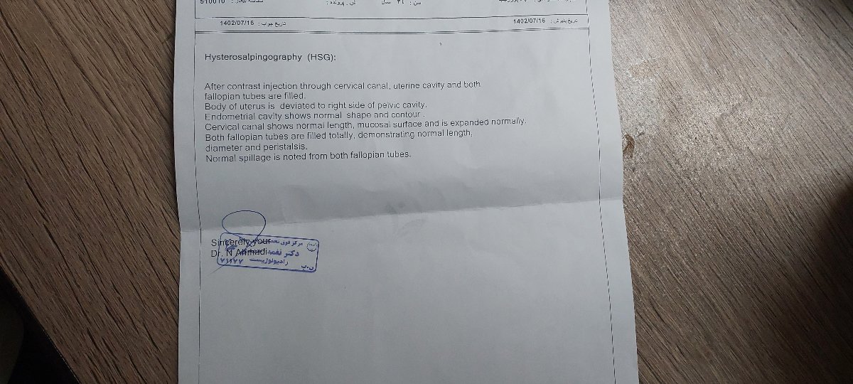 تفسیر سونوگرافی کیست و آندومتریوز تفسیر سونوگرافی کیست و آندومتریوز
