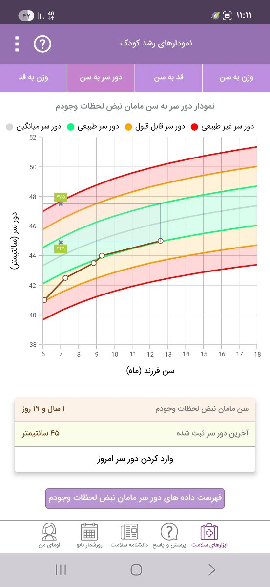 دور سر