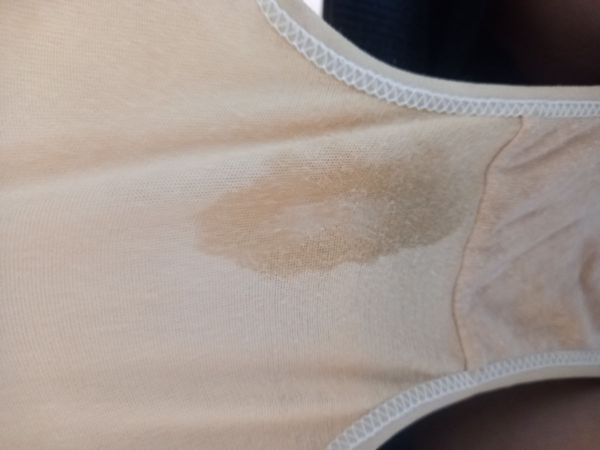 نشتی کیسه آب یا ترشح(عکس)