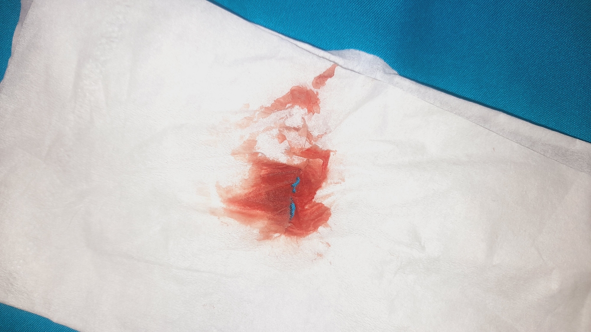 الانم دوباره خون دیدم 
اینطوریه 😥
۳ روزم به پریودم مونده