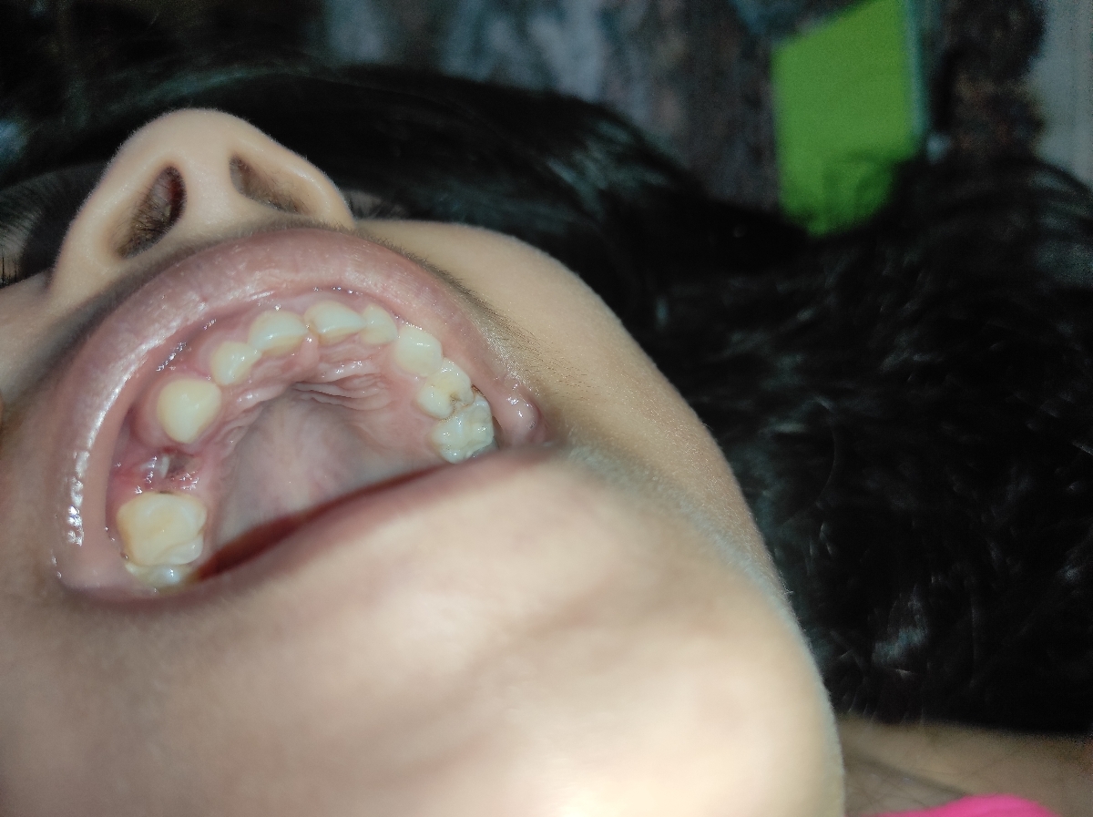 نگه دار دندان برا کودک هفت ساله