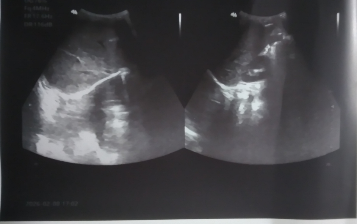 تفسیر سونوی پسرم تفسیر سونوی پسرم