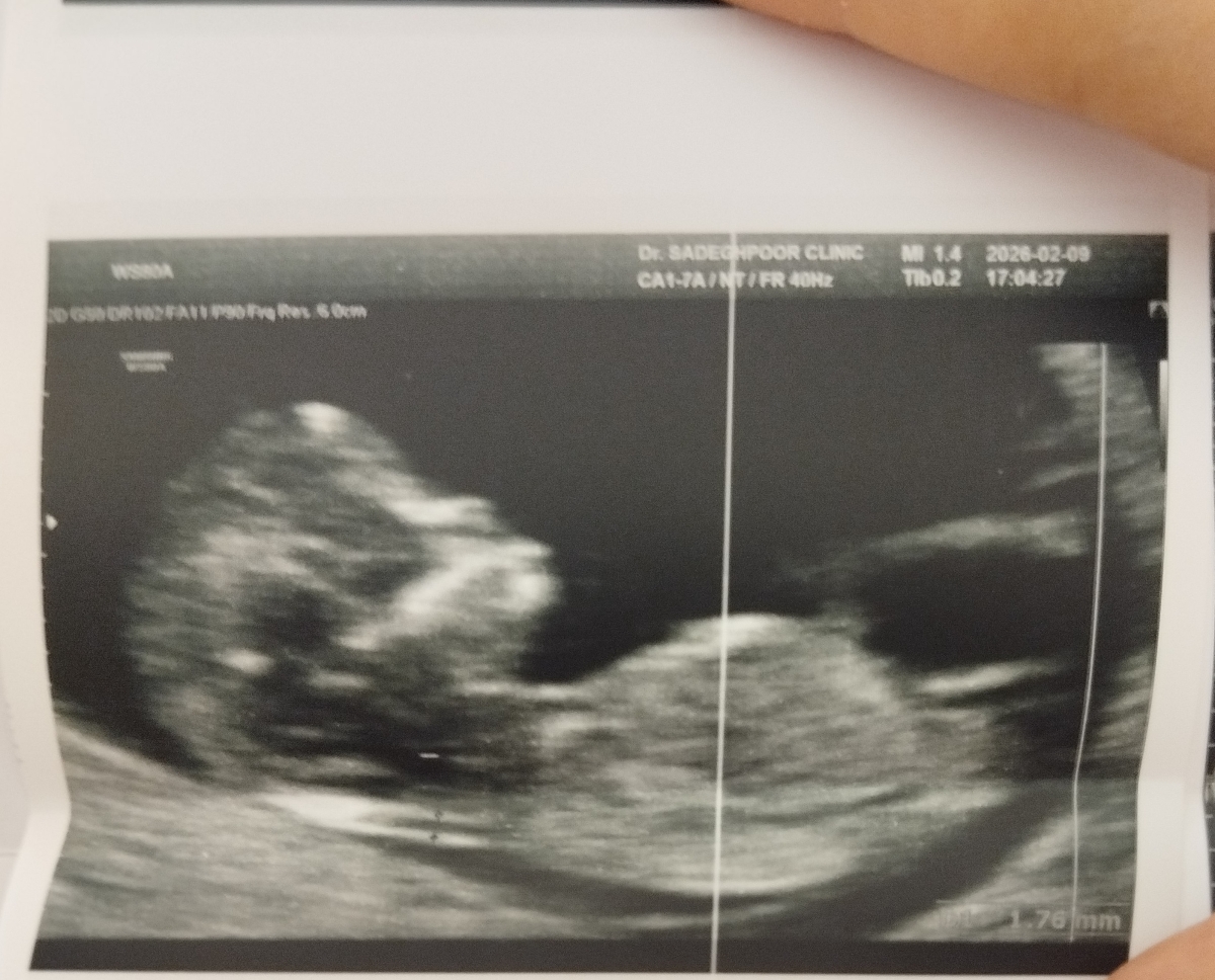 تشخیص جنسیت 😬 😀