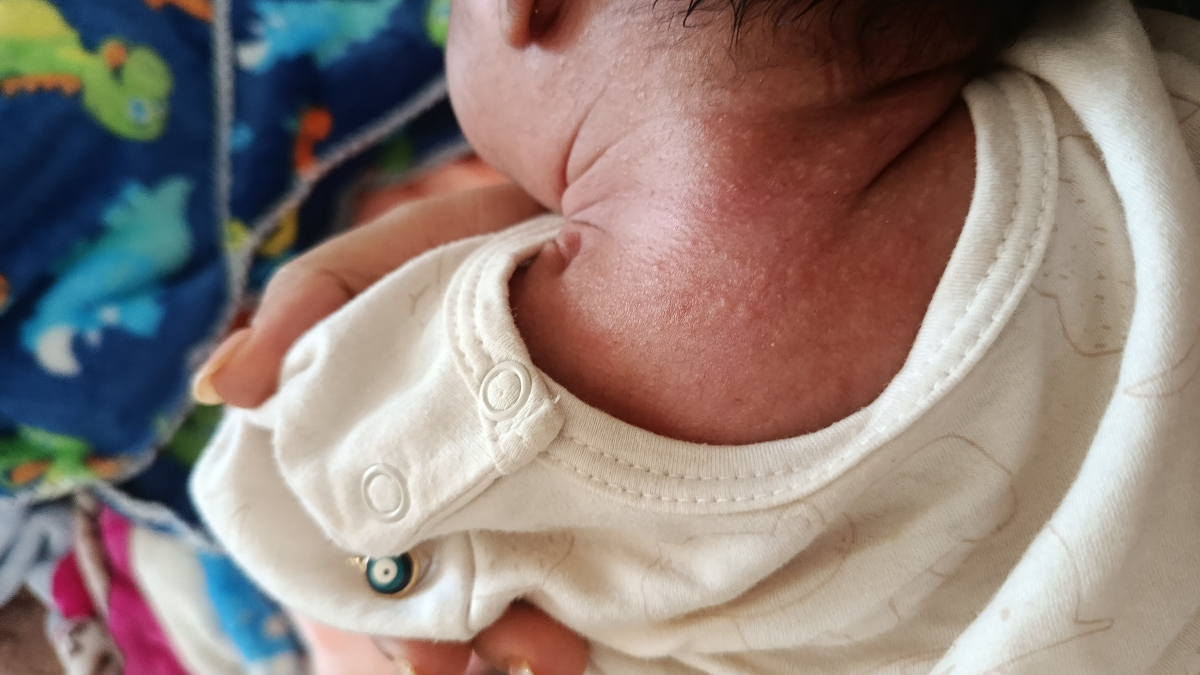 خانم دکتر این پروتیین گاویه یعنی؟؟!!! حساسیت داده⭕⭕⭕