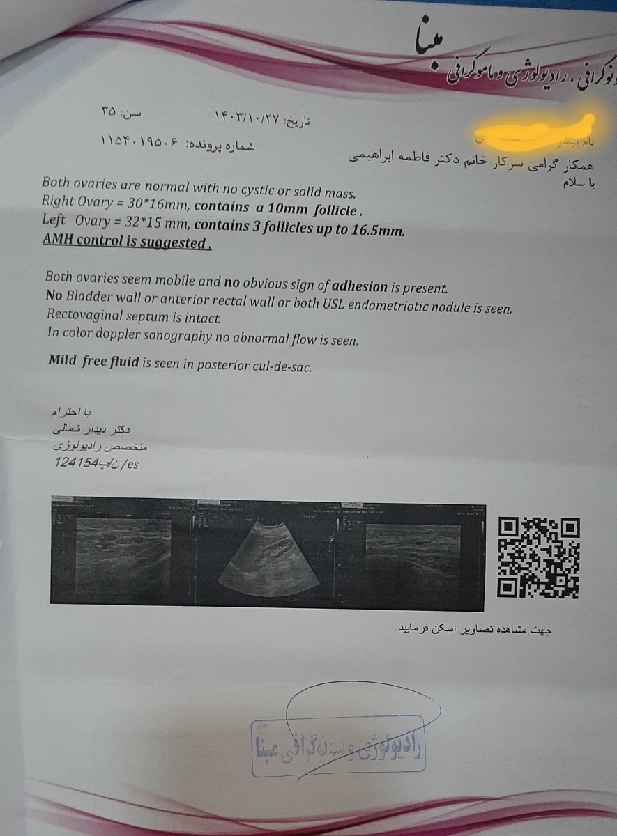 بررسی وضعیت هورمونی و تخمدان بررسی وضعیت هورمونی و تخمدان